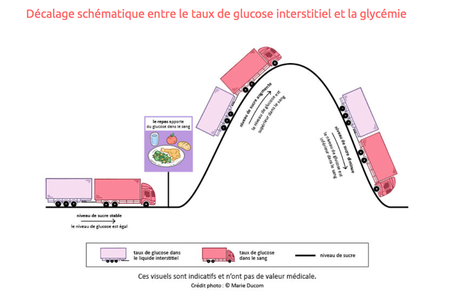 La mesure en continu du glucose  Association Acredia Atlantique